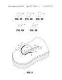 Wound Closure Device diagram and image