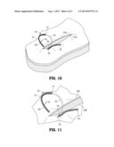 Wound Closure Device diagram and image