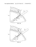 BIASED WEDGE SUTURE ANCHOR AND METHOD FOR SOFT TISSUE REPAIR diagram and image