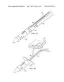 BIASED WEDGE SUTURE ANCHOR AND METHOD FOR SOFT TISSUE REPAIR diagram and image