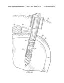 BIASED WEDGE SUTURE ANCHOR AND METHOD FOR SOFT TISSUE REPAIR diagram and image