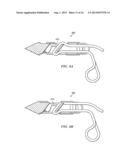 BIASED WEDGE SUTURE ANCHOR AND METHOD FOR SOFT TISSUE REPAIR diagram and image