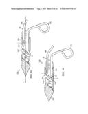 BIASED WEDGE SUTURE ANCHOR AND METHOD FOR SOFT TISSUE REPAIR diagram and image