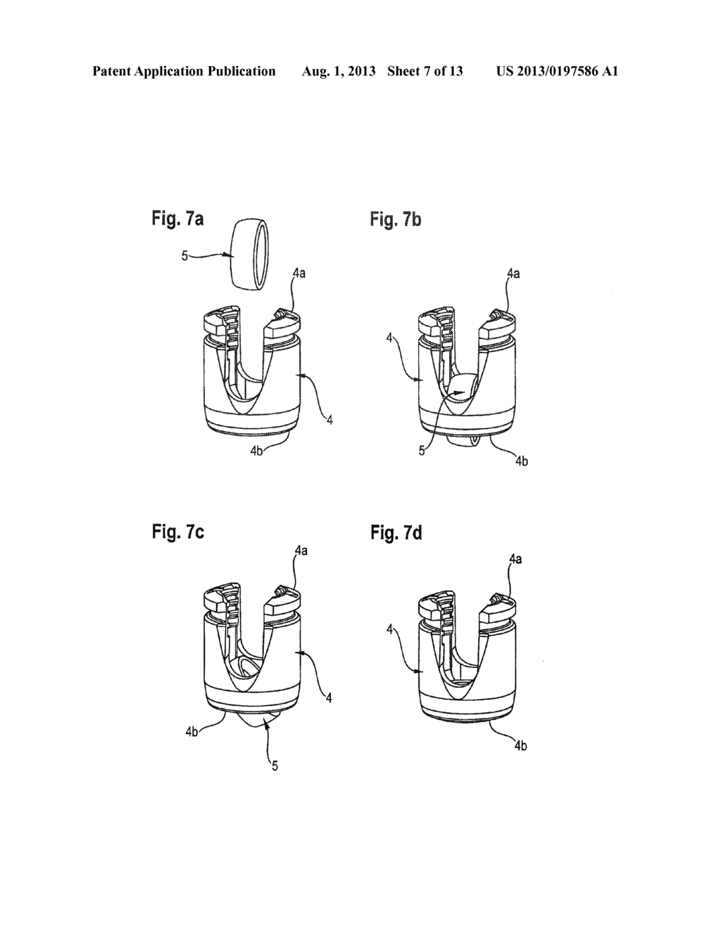 BONE ANCHORING DEVICE - diagram, schematic, and image 08