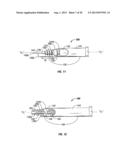 SURGICAL FASTENER WITH PREDETERMINED RESORPTION RATE diagram and image