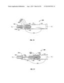 SURGICAL FASTENER WITH PREDETERMINED RESORPTION RATE diagram and image