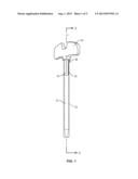 ANCHORING CANNULA diagram and image