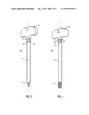 ANCHORING CANNULA diagram and image