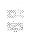 DURABLE MULTI-LAYER HIGH STRENGTH POLYMER COMPOSITE SUITABLE FOR IMPLANT     AND ARTICLES PRODUCED THEREFROM diagram and image