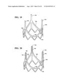 DURABLE MULTI-LAYER HIGH STRENGTH POLYMER COMPOSITE SUITABLE FOR IMPLANT     AND ARTICLES PRODUCED THEREFROM diagram and image