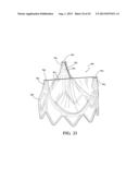 DURABLE MULTI-LAYER HIGH STRENGTH POLYMER COMPOSITE SUITABLE FOR IMPLANT     AND ARTICLES PRODUCED THEREFROM diagram and image