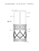 DURABLE MULTI-LAYER HIGH STRENGTH POLYMER COMPOSITE SUITABLE FOR IMPLANT     AND ARTICLES PRODUCED THEREFROM diagram and image