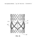 DURABLE MULTI-LAYER HIGH STRENGTH POLYMER COMPOSITE SUITABLE FOR IMPLANT     AND ARTICLES PRODUCED THEREFROM diagram and image