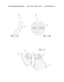 VERTEBRAL FACET JOINT PROSTHESIS AND METHOD OF FIXATION diagram and image