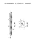 EXPANDABLE SPINAL INTERBODY AND INTRAVERTEBRAL BODY DEVICES diagram and image