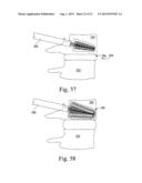 EXPANDABLE SPINAL INTERBODY AND INTRAVERTEBRAL BODY DEVICES diagram and image