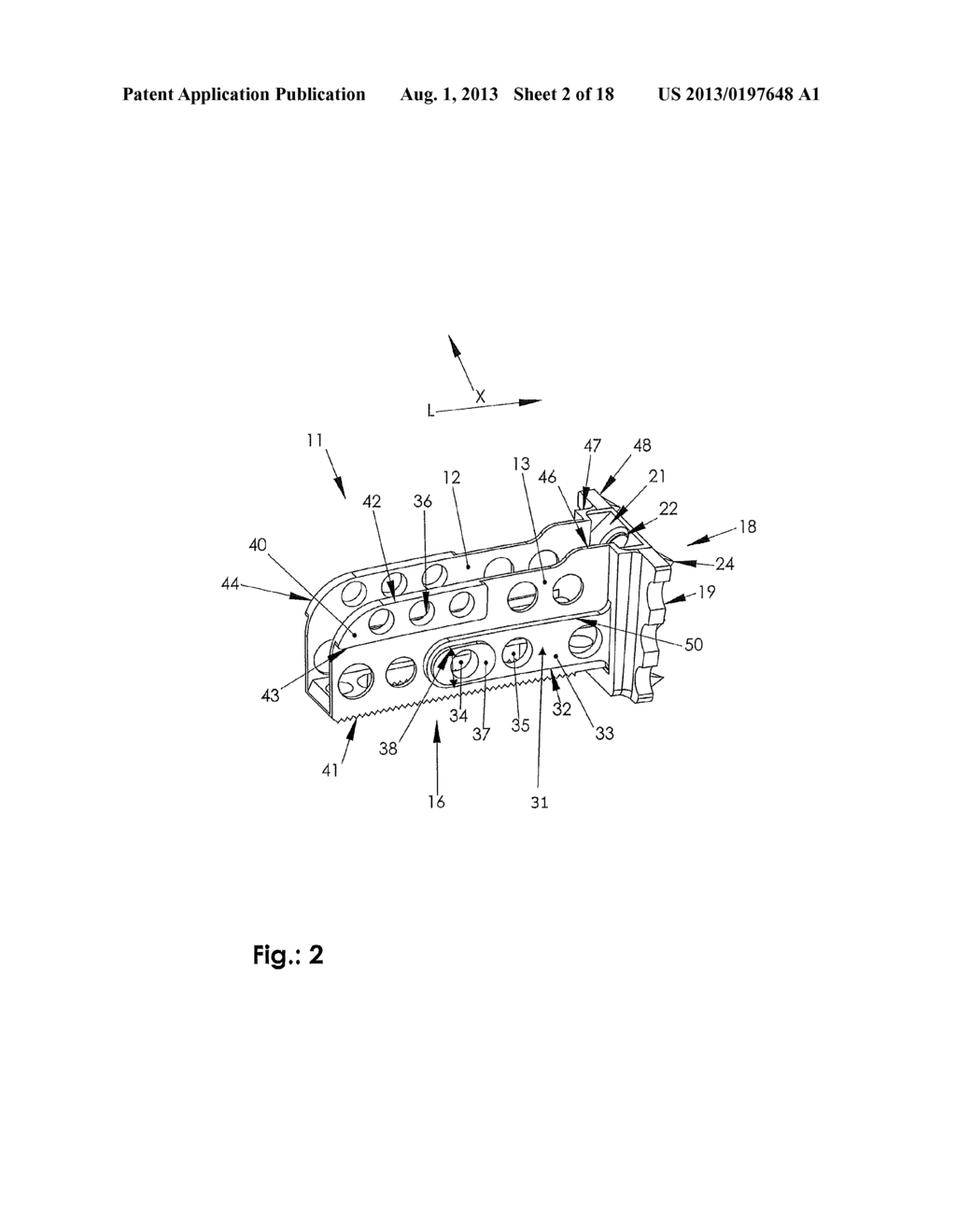 IMPLANT FOR THE SPINAL COLUMN AND ACTUATING INSTRUMENT - diagram, schematic, and image 03