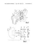 CONVERTIBLE GLENOID IMPLANT diagram and image