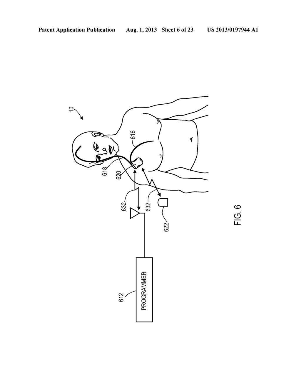 Techniques for Data Reporting in an Implantable Medical Device - diagram, schematic, and image 07