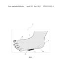 DEVICE FOR FOOT COMFORT diagram and image