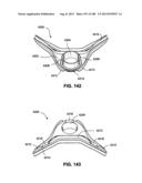 MASK SYSTEM diagram and image