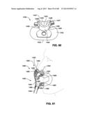 MASK SYSTEM diagram and image