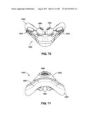 MASK SYSTEM diagram and image