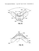 MASK SYSTEM diagram and image