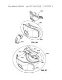 MASK SYSTEM diagram and image