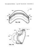 MASK SYSTEM diagram and image