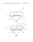 Mouth Guard diagram and image