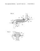 GROMMET diagram and image