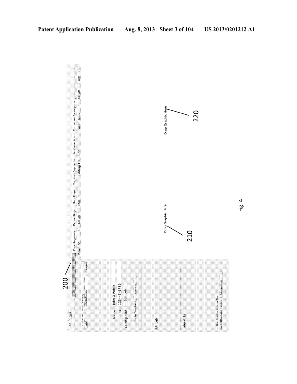 External Fixator Deformity Correction Systems and Methods - diagram, schematic, and image 04