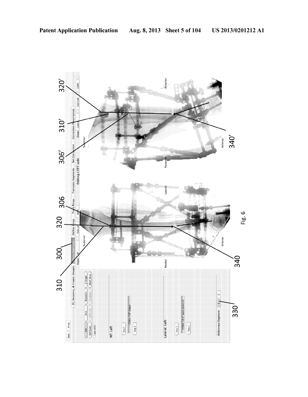 External Fixator Deformity Correction Systems and Methods - diagram, schematic, and image 06