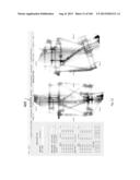 External Fixator Deformity Correction Systems and Methods diagram and image