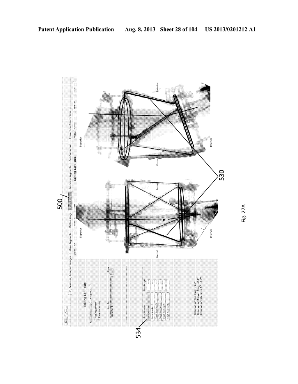 External Fixator Deformity Correction Systems and Methods - diagram, schematic, and image 29