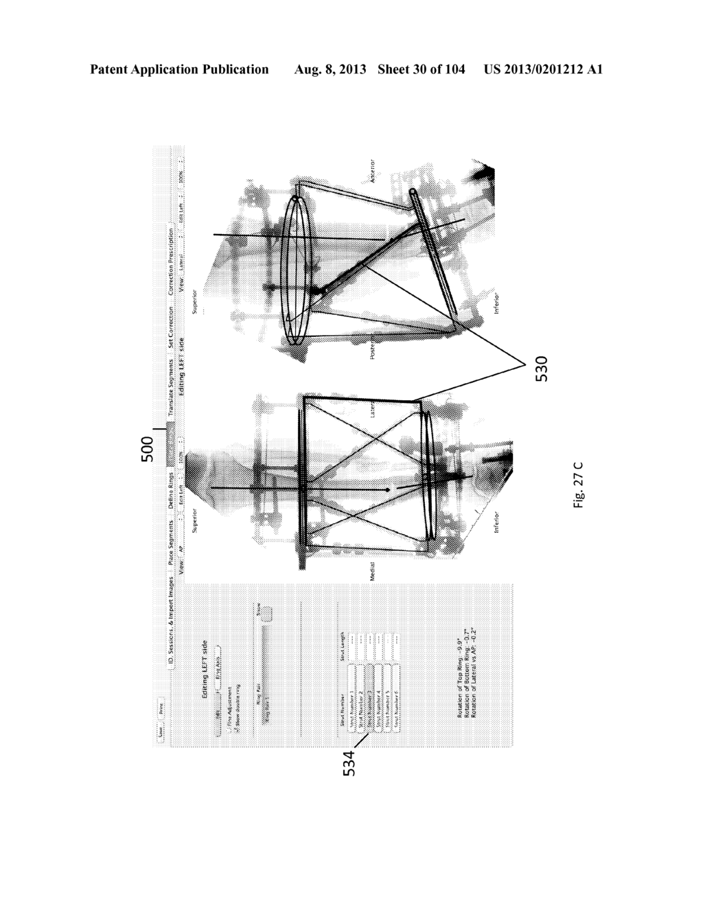 External Fixator Deformity Correction Systems and Methods - diagram, schematic, and image 31