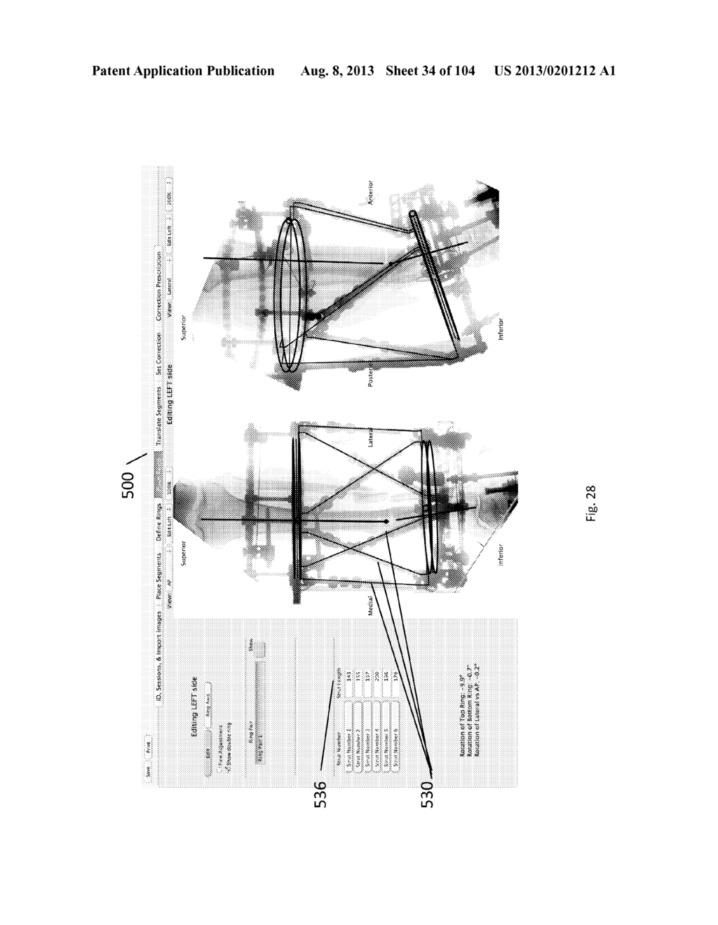 External Fixator Deformity Correction Systems and Methods - diagram, schematic, and image 35