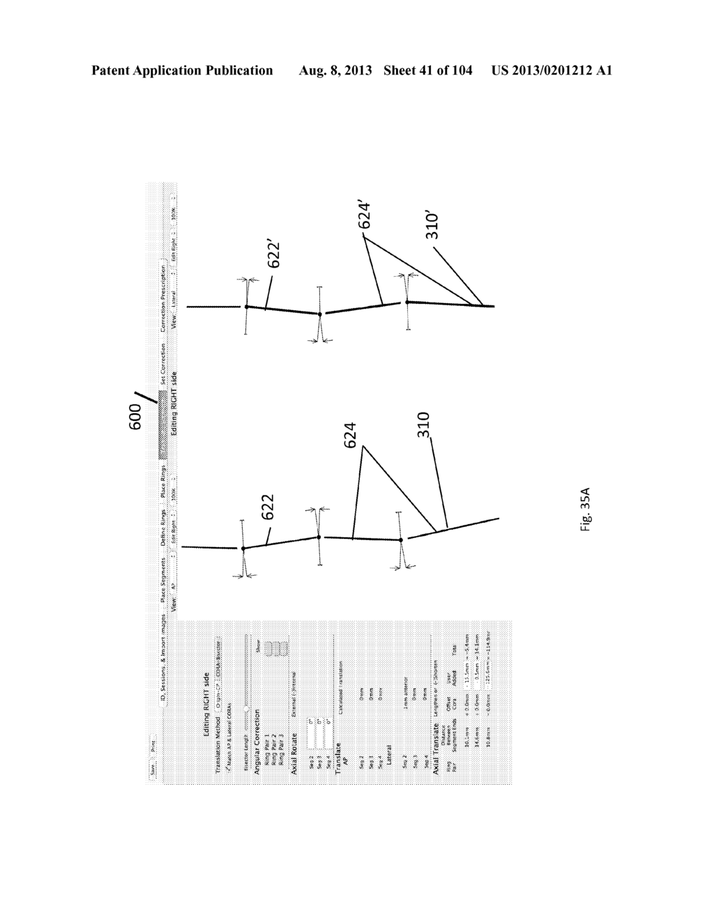 External Fixator Deformity Correction Systems and Methods - diagram, schematic, and image 42