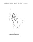 External Fixator Deformity Correction Systems and Methods diagram and image