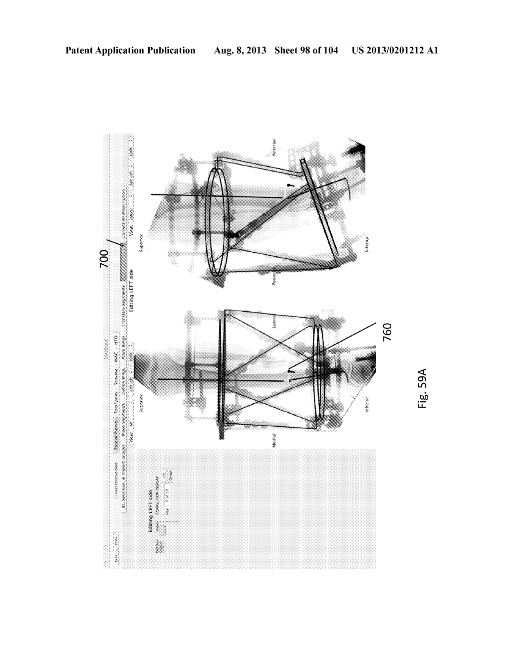 External Fixator Deformity Correction Systems and Methods - diagram, schematic, and image 99