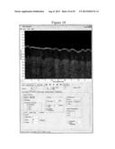 Systems for Processing Images Generated Using Fourier Domain Optical     Coherence Tomography (FDOCT) diagram and image