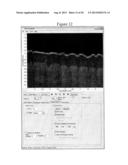 Systems for Processing Images Generated Using Fourier Domain Optical     Coherence Tomography (FDOCT) diagram and image