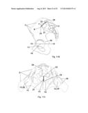 METHOD AND A SYSTEM FOR MULTI-DIMENSIONAL VISUALIZATION OF THE SPINAL     COLUMN BY VERTEBRA VECTORS, SACRUM VECTOR, SACRUM PLATEAU VECTOR AND     PELVIS VECTOR diagram and image