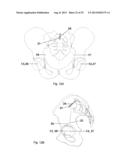 METHOD AND A SYSTEM FOR MULTI-DIMENSIONAL VISUALIZATION OF THE SPINAL     COLUMN BY VERTEBRA VECTORS, SACRUM VECTOR, SACRUM PLATEAU VECTOR AND     PELVIS VECTOR diagram and image