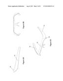 VIDEO CAMERA BAND AND SYSTEM diagram and image