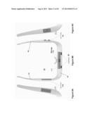 VIDEO CAMERA BAND AND SYSTEM diagram and image