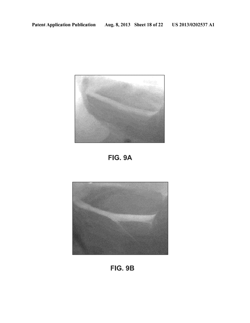 COMPOSITIONS FOR LABELING NERVES AND METHODS OF USE - diagram, schematic, and image 19