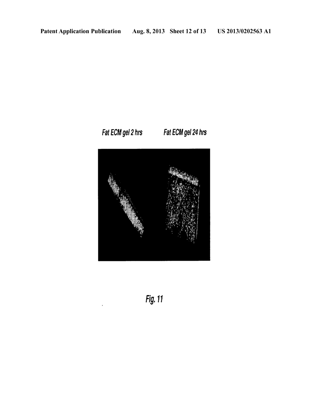 DECELLULARIZED ADIPOSE CELL GROWTH SCAFFOLD - diagram, schematic, and image 13