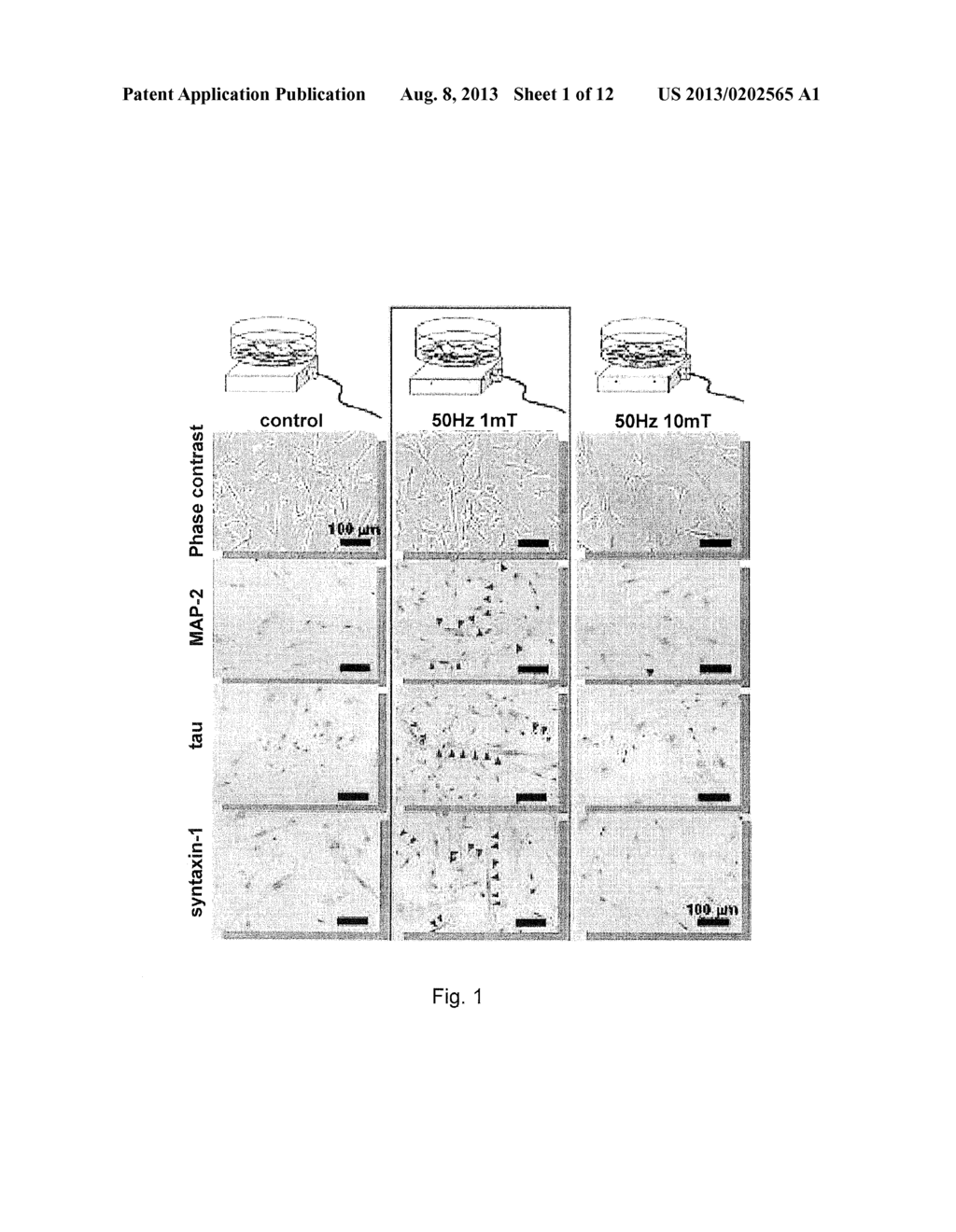 METHOD FOR INDUCING DIFFERENTIATION OF ADULT STEM CELLS AND NERVE CELLS     USING ELECTROMAGNETIC FIELD - diagram, schematic, and image 02